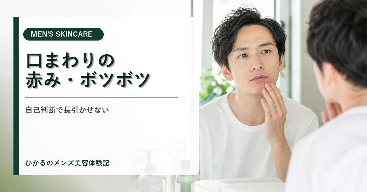 30代男性の口まわりの赤み・ボツボツは何だった？脂漏性皮膚炎と診断されるまでの失敗セルフケア